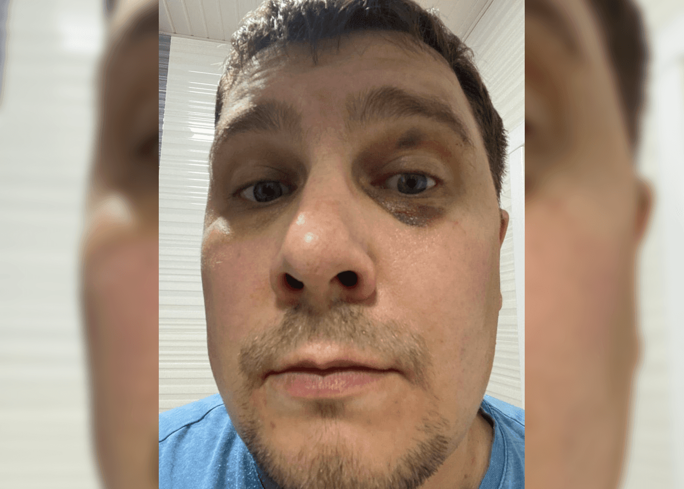 В Петербурге за антивоенную позицию избили активиста Олега Клименчука