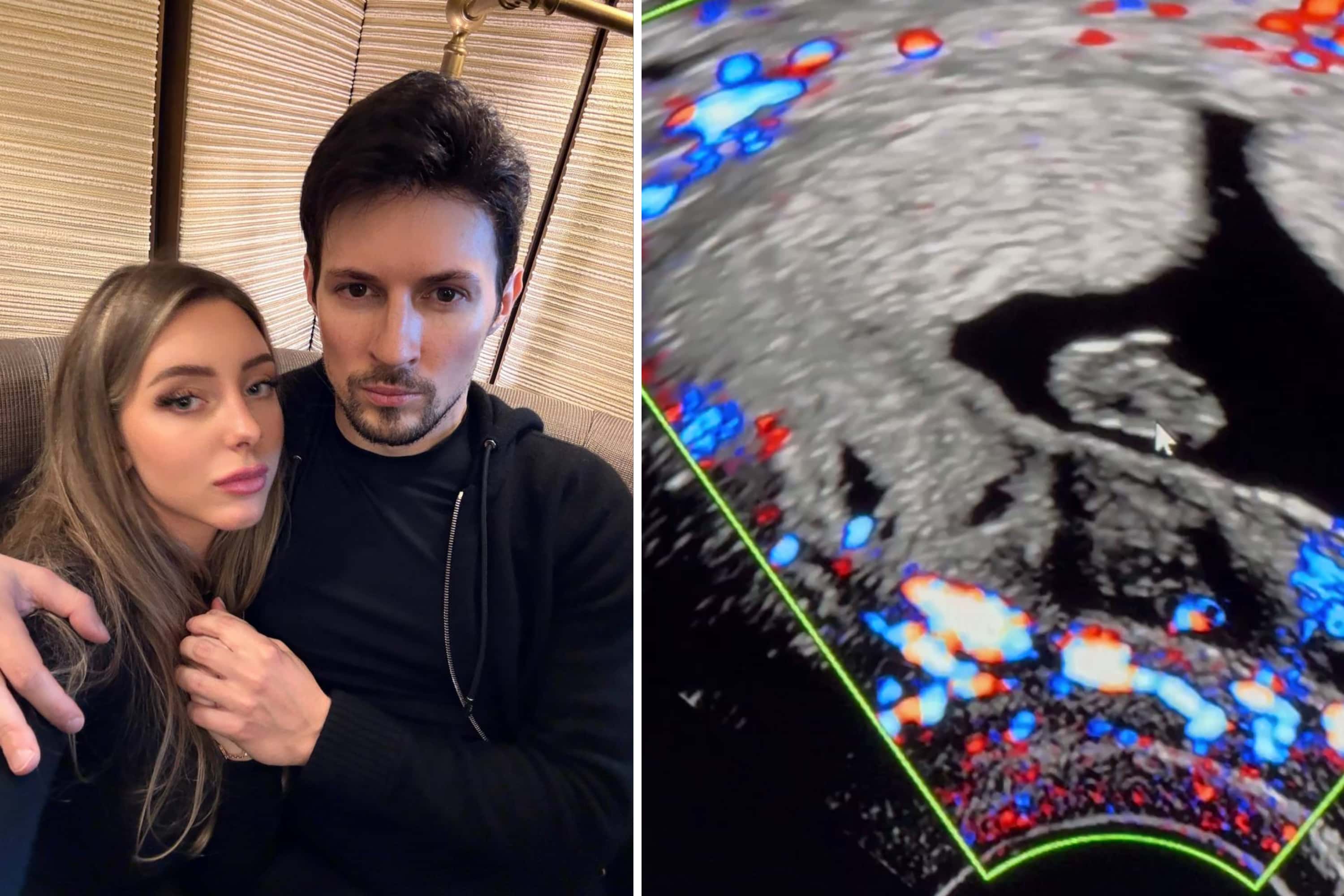 Павел Дуров рассказал, что после задержания во Франции его девушка Юлия потеряла ребенка