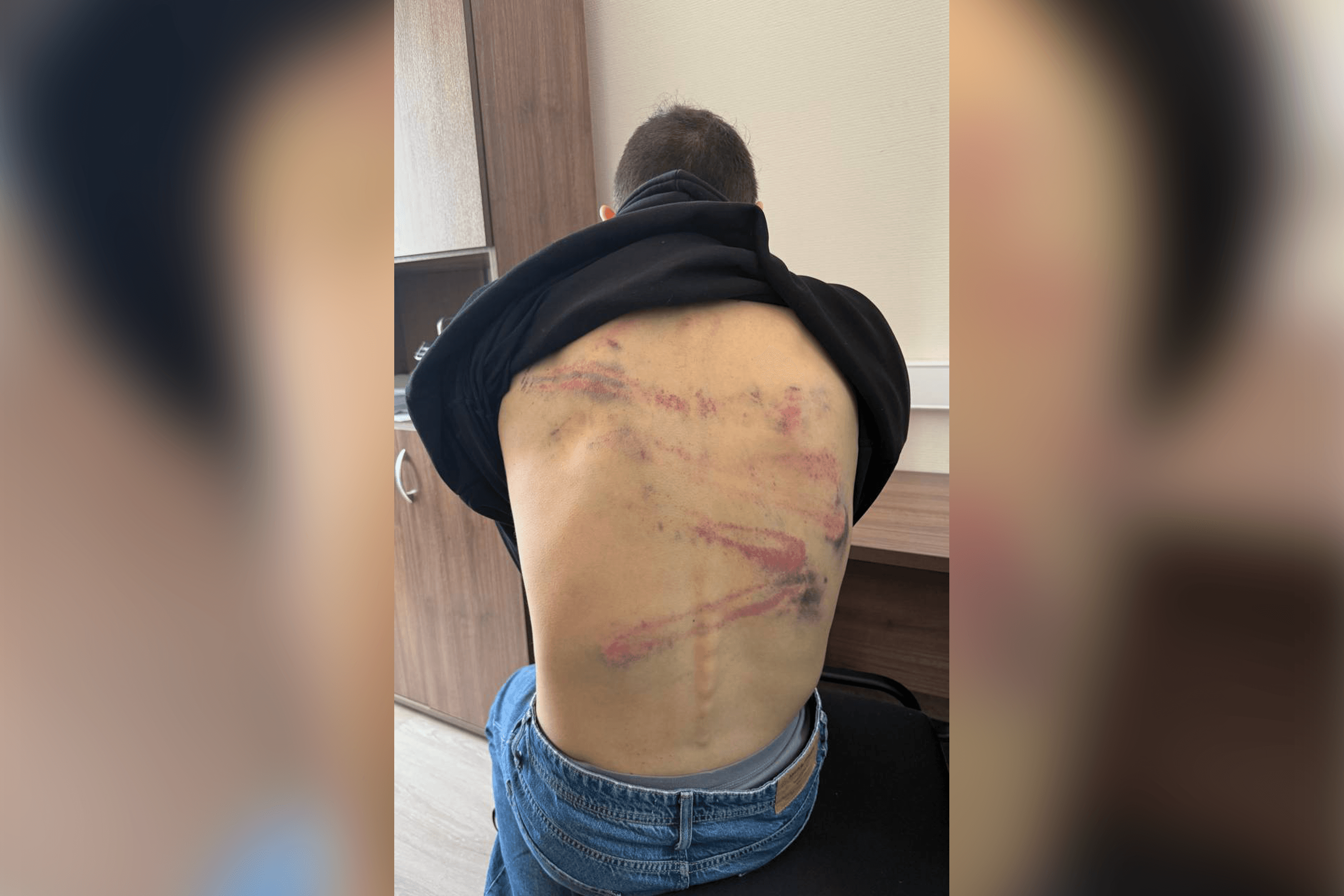 Комика Останина, пошутившего про безногого инвалида, после задержания в Беларуси вывезли в лес и сломали позвоночник